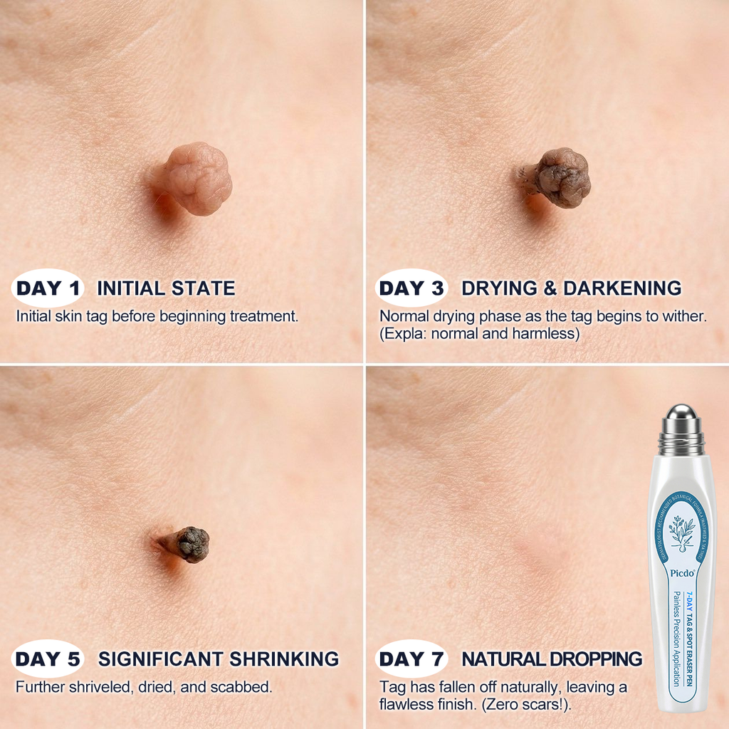 GlowVive™ — Reveal Radiant, Blemish-Free Skin in Just 7 Days Without Pain or Scars
