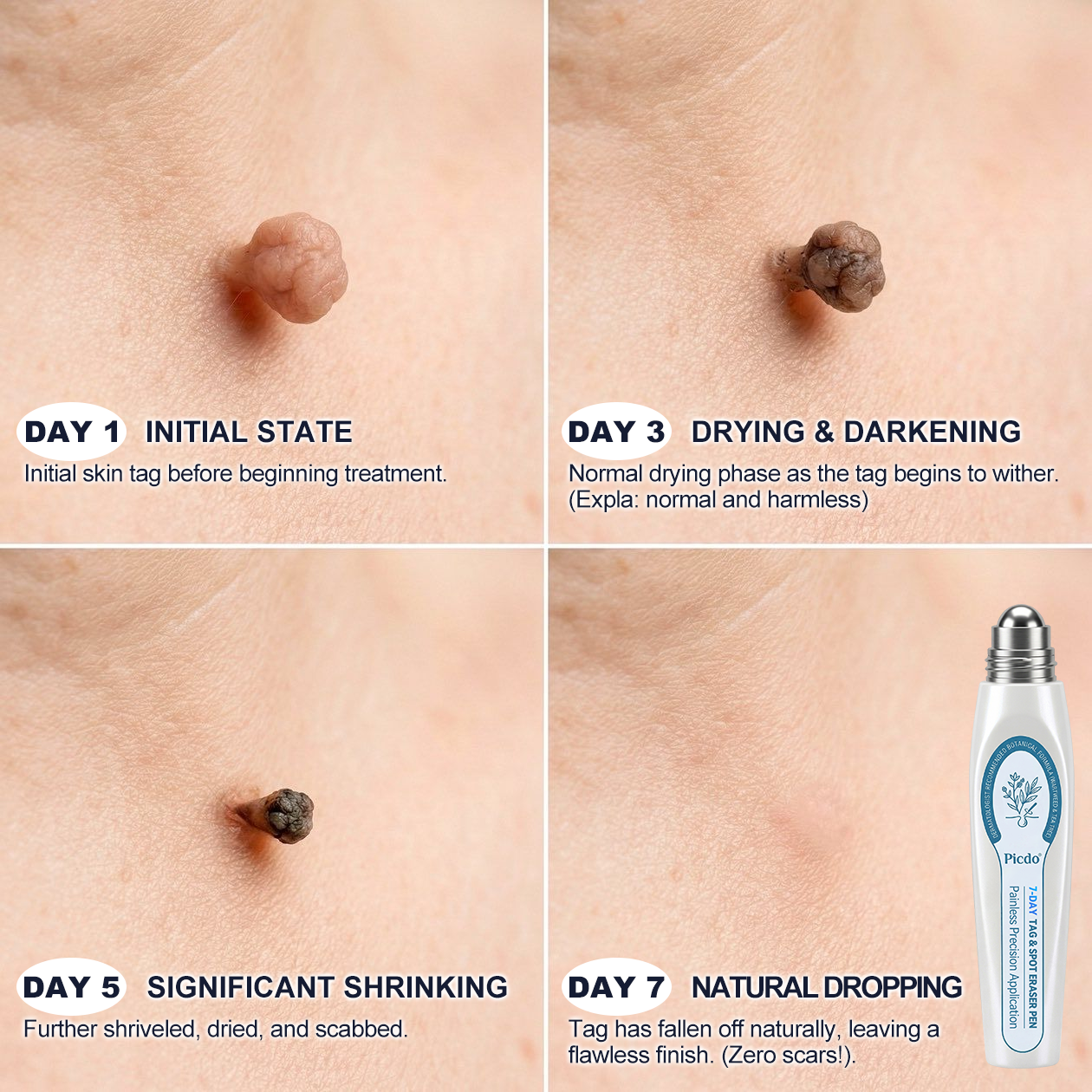 GlowVive™ — Reveal Radiant, Blemish-Free Skin in Just 7 Days Without Pain or Scars