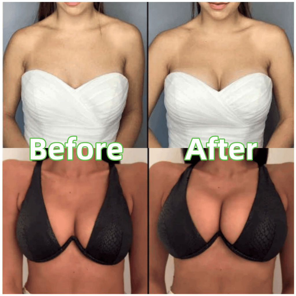 CurvaLift™ — Unlock Head-Turning Curves That Stay Perfect All Day