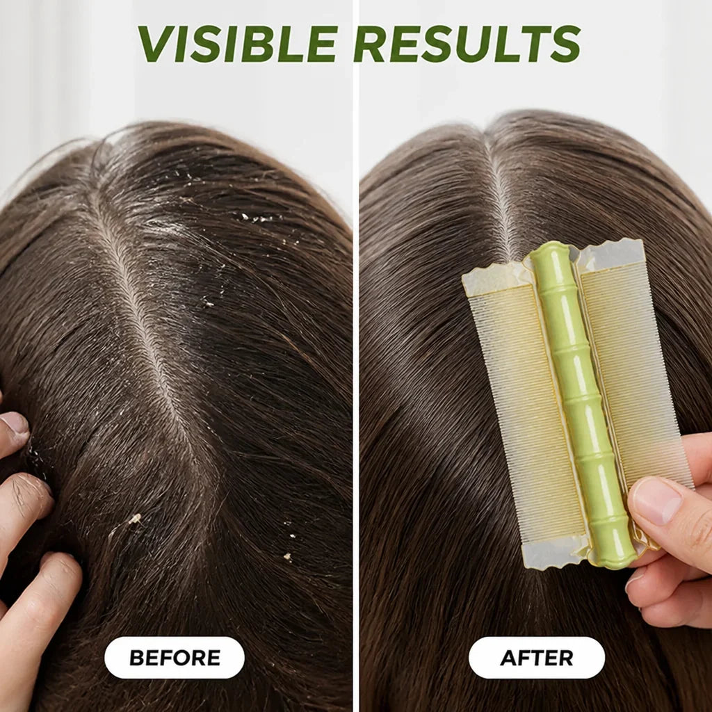 Bamboora™ — Smooth Scalp Care With Gentle Bamboo Comfort