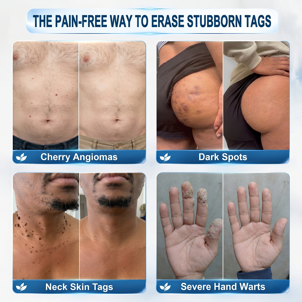 GlowVive™ — Reveal Radiant, Blemish-Free Skin in Just 7 Days Without Pain or Scars