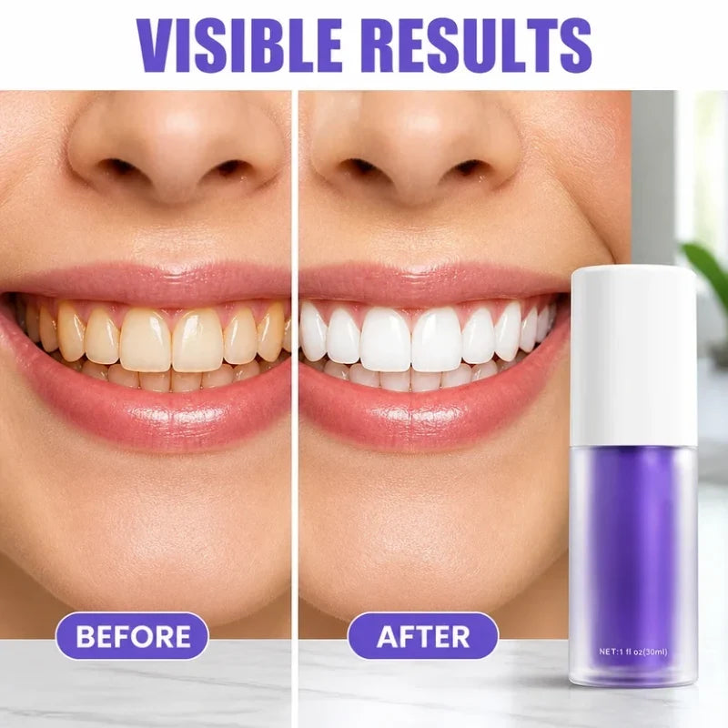 SmileBright™ — Easy Care for a Cleaner-Looking Smile