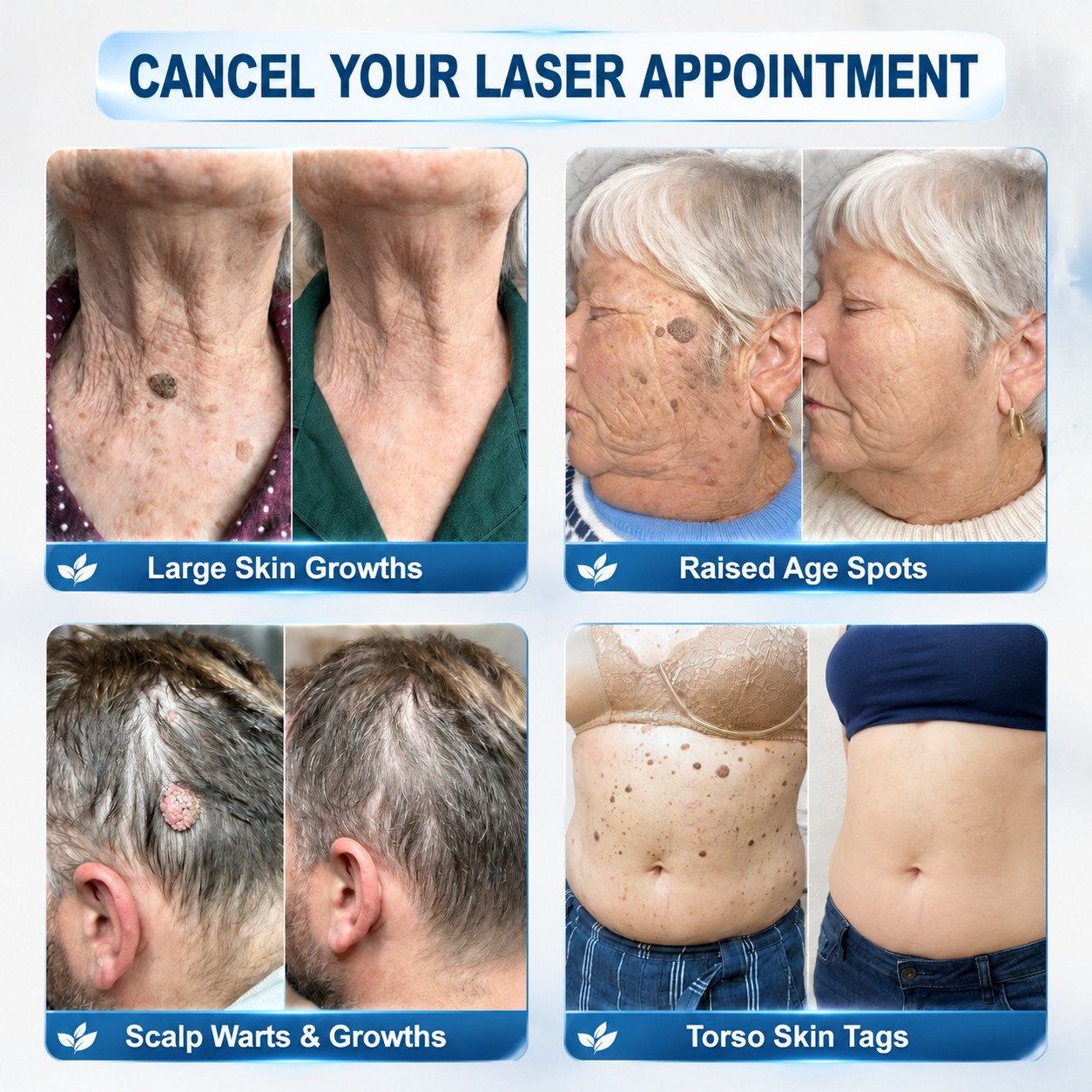GlowVive™ — Reveal Radiant, Blemish-Free Skin in Just 7 Days Without Pain or Scars